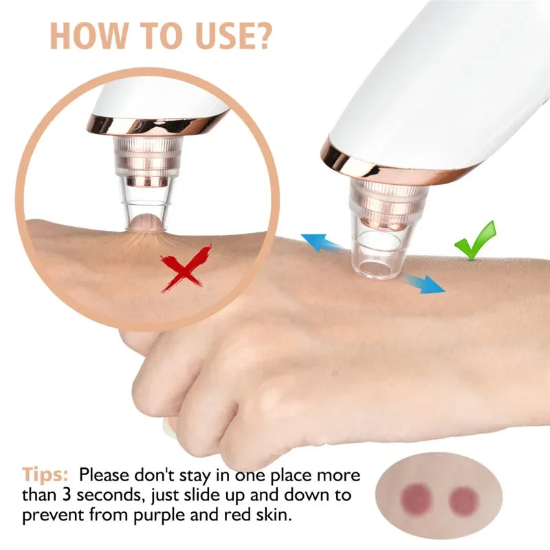 Blackhead Remover Vacuum Suction USB Rechargeable Facial Pore Cleaner Comedone Spot Acne Pimple Black Head Extractor Care Tools (Copy)