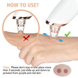 Blackhead Remover Vacuum Suction USB Rechargeable Facial Pore Cleaner Comedone Spot Acne Pimple Black Head Extractor Care Tools (Copy)