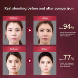 LED Photon Therapy Facial Vibration Massager Slimming Lifting Device Heated Double Chin Face V Lifter Rechargeable Beauty Tool