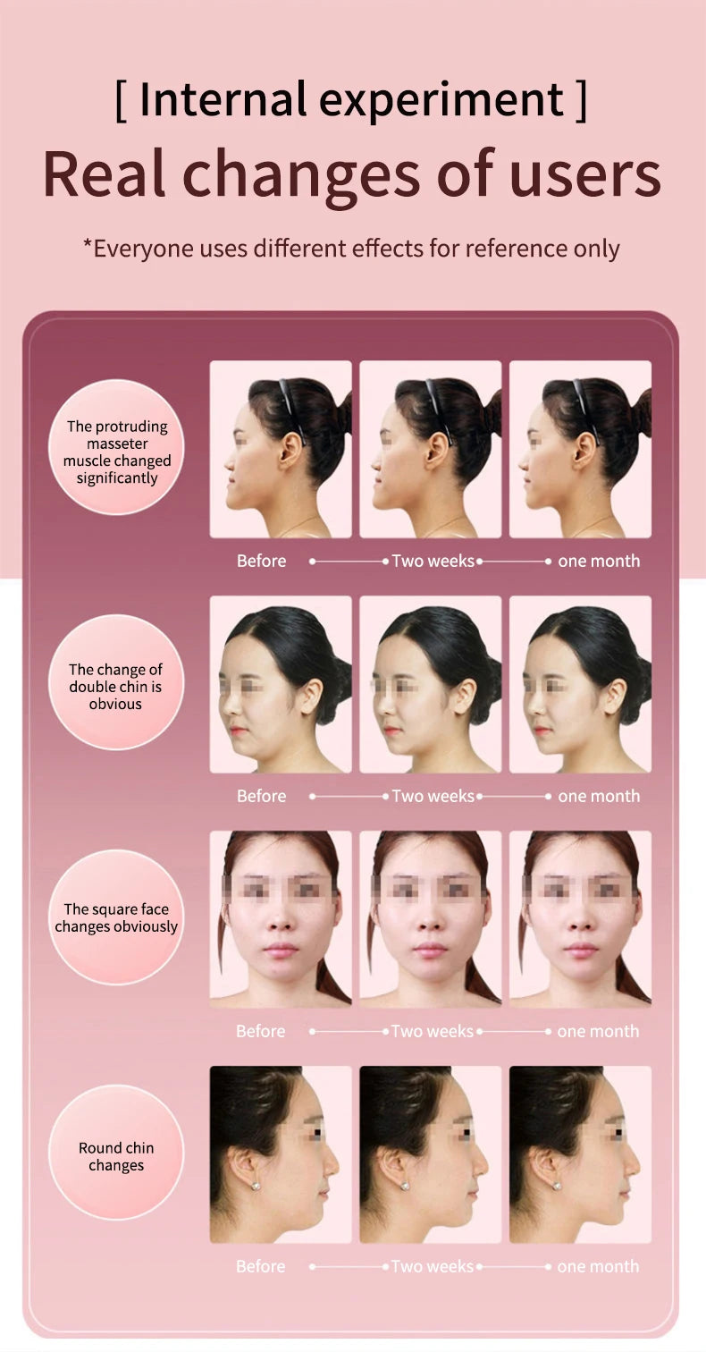 LED Photon Therapy Facial Vibration Massager Slimming Lifting Device Heated Double Chin Face V Lifter Rechargeable Beauty Tool